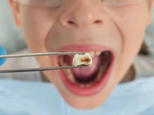 Best Weekend Emergency Dentist in Brandermill, VA